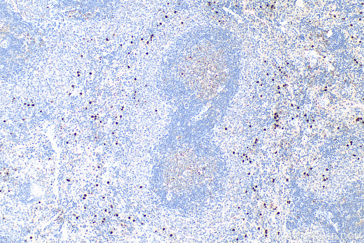 Immunohistochemistry (IHC) staining of rat spleen tissue using S100A8 Polyclonal antibody (15792-1-AP)