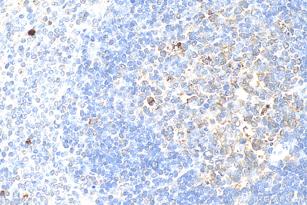 Immunohistochemistry (IHC) staining of rat spleen tissue using S100A8 Polyclonal antibody (15792-1-AP)