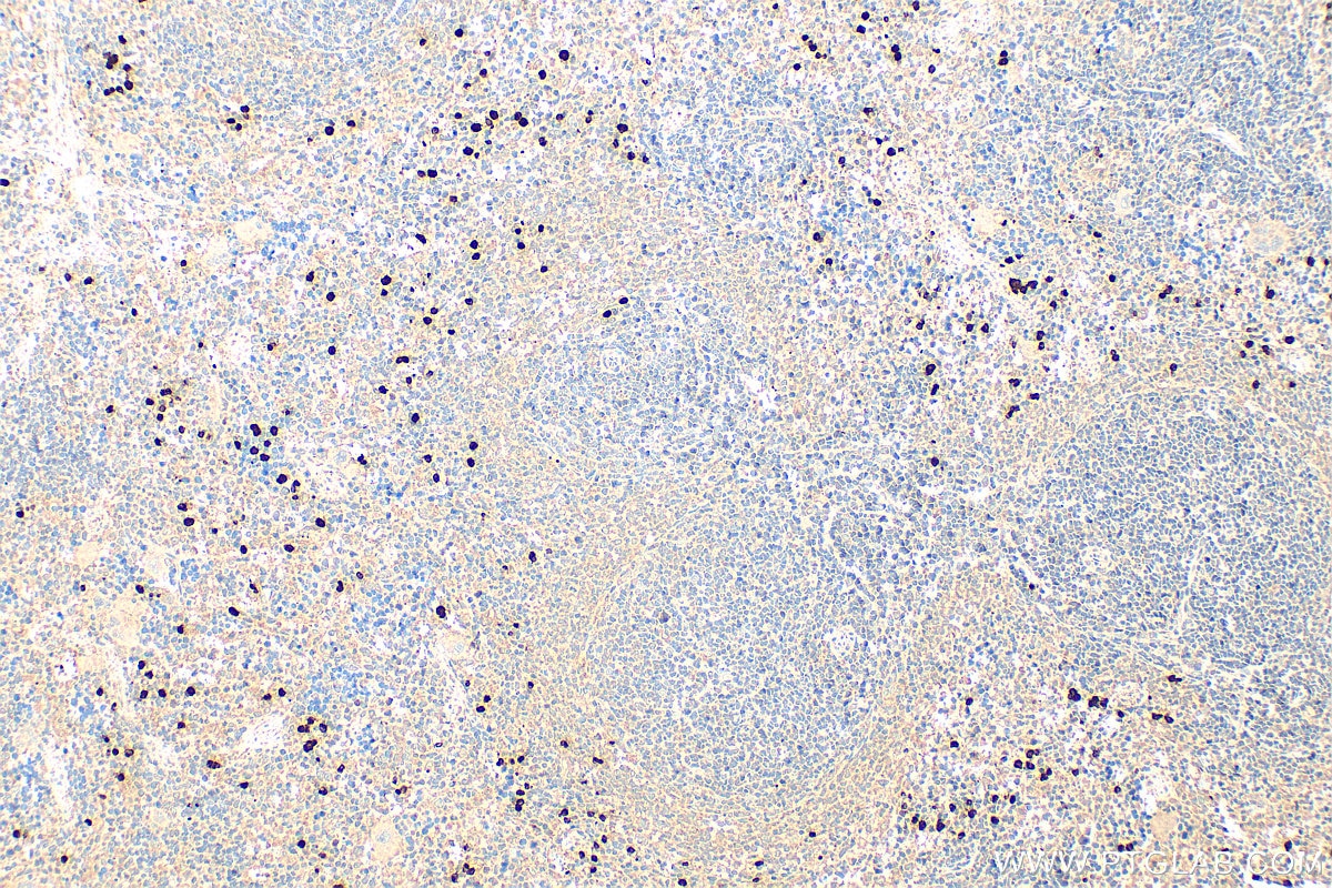 Immunohistochemistry (IHC) staining of rat spleen tissue using S100A8 Polyclonal antibody (15792-1-AP)