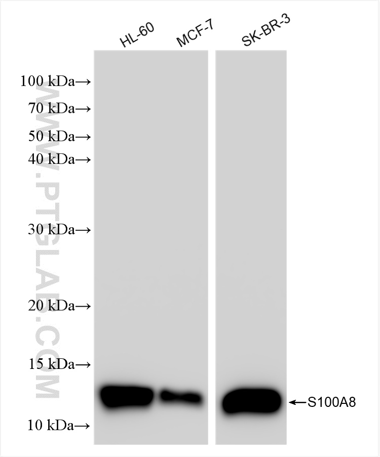 Western Blot (WB) analysis of various lysates using S100A8 Recombinant antibody (82531-3-RR)
