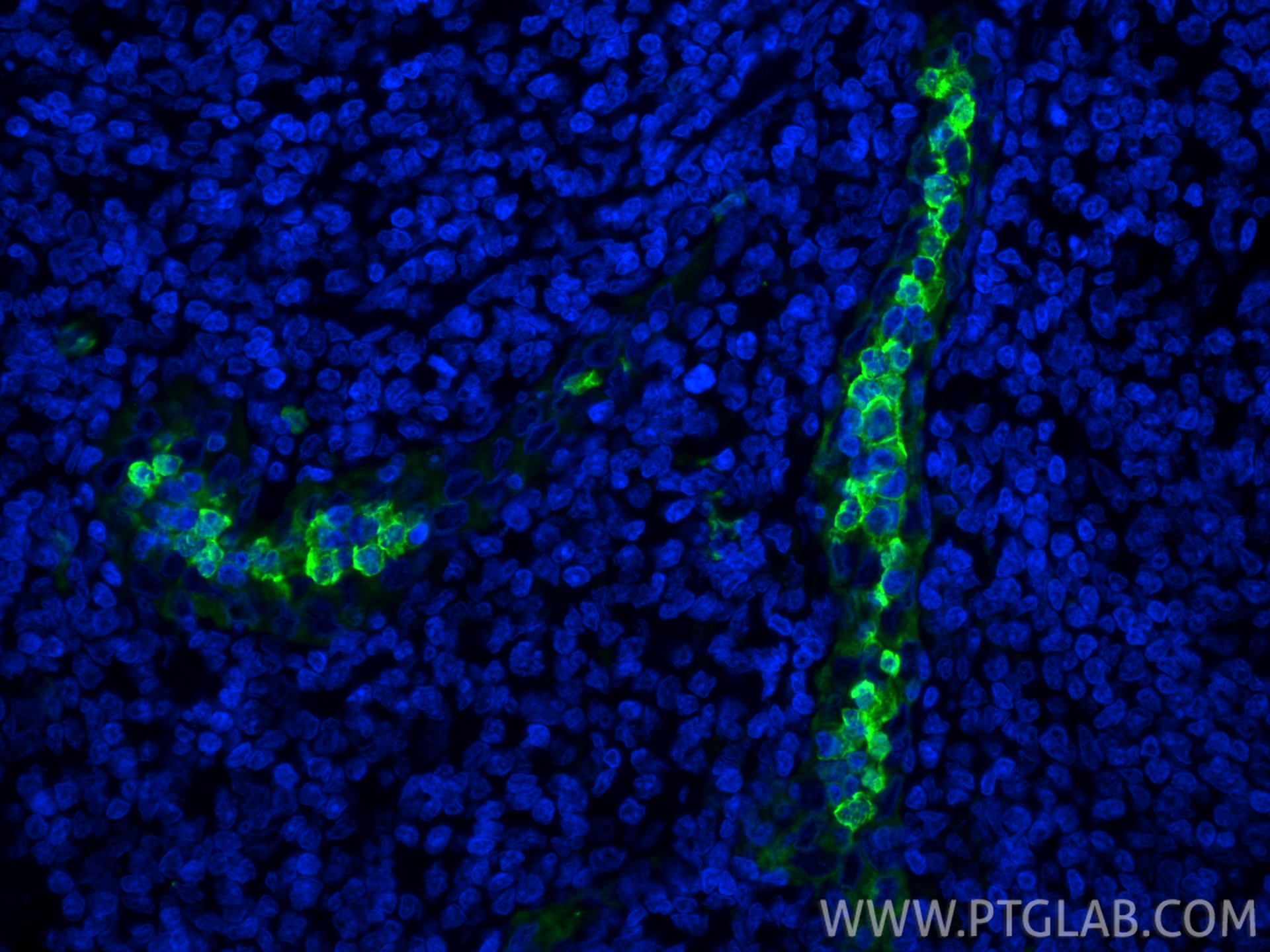 Immunofluorescence (IF) / fluorescent staining of human tonsillitis tissue using S100A9 Polyclonal antibody (26992-1-AP)