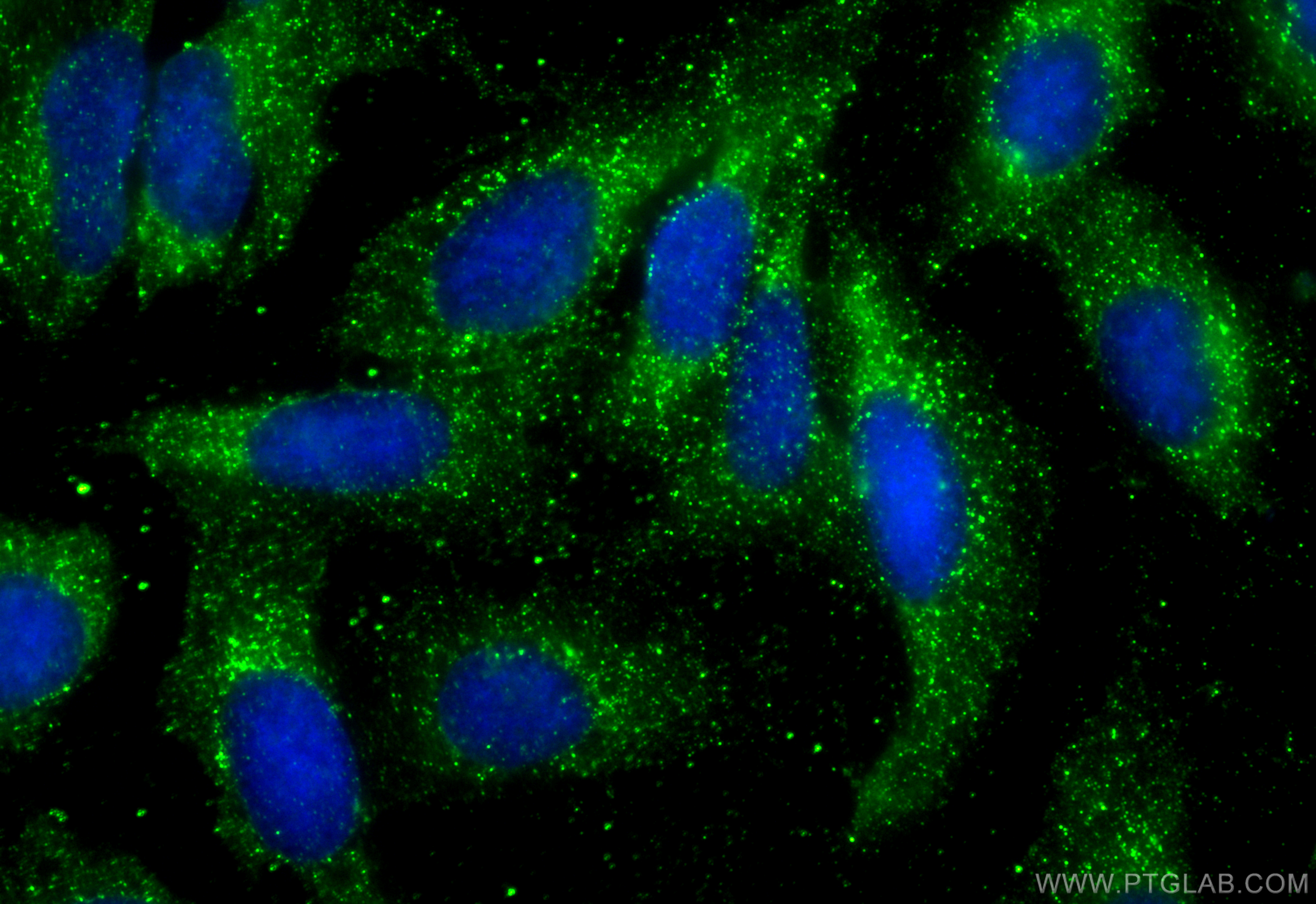 Immunofluorescence (IF) / fluorescent staining of U2OS cells using S100A9 Monoclonal antibody (68900-1-Ig)