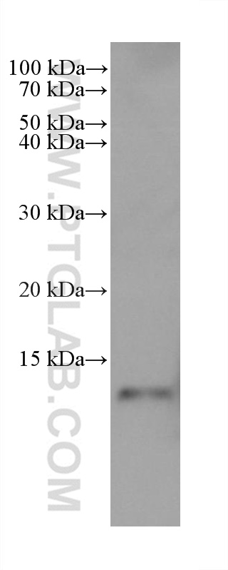 Western Blot (WB) analysis of SK-BR-3 cells using S100A9 Monoclonal antibody (68900-1-Ig)