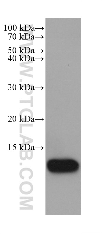 Western Blot (WB) analysis of MDA-MB-468 cells using S100A9 Monoclonal antibody (68900-1-Ig)