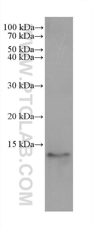 Western Blot (WB) analysis of HT-1376 cells using S100A9 Monoclonal antibody (68900-1-Ig)