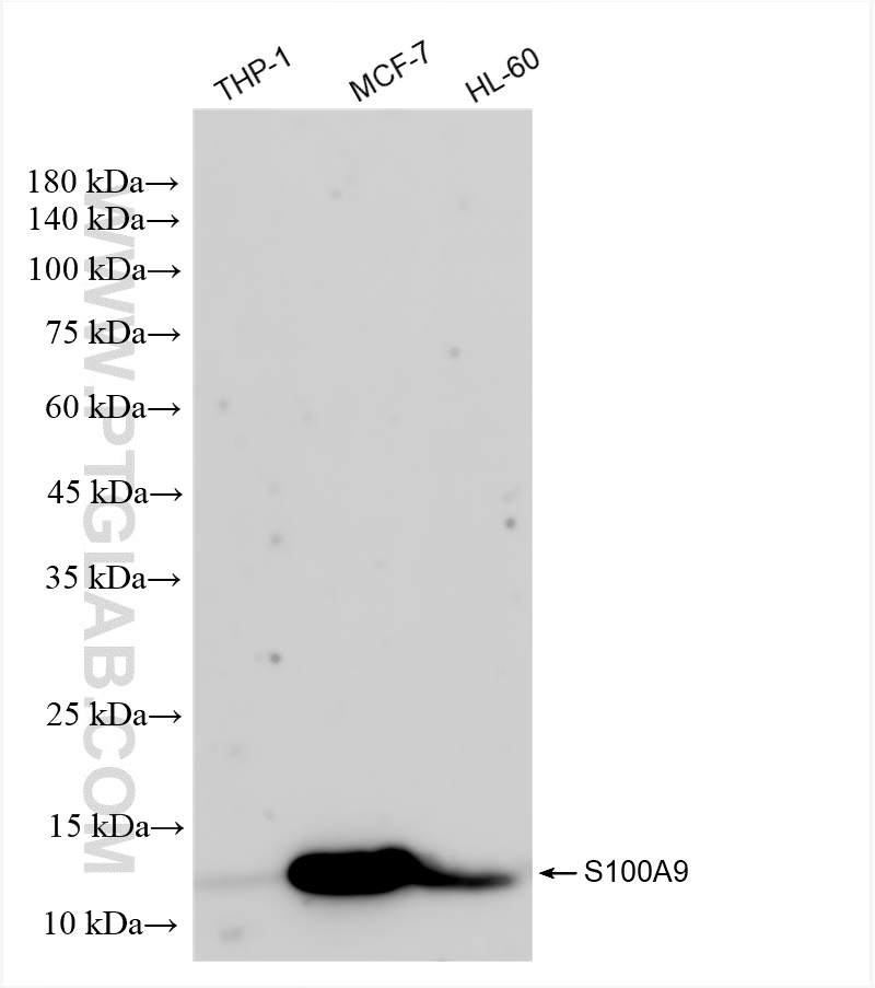 Western Blot (WB) analysis of various lysates using S100A9 Recombinant antibody, PBS Only (Capture) (83578-2-PBS)