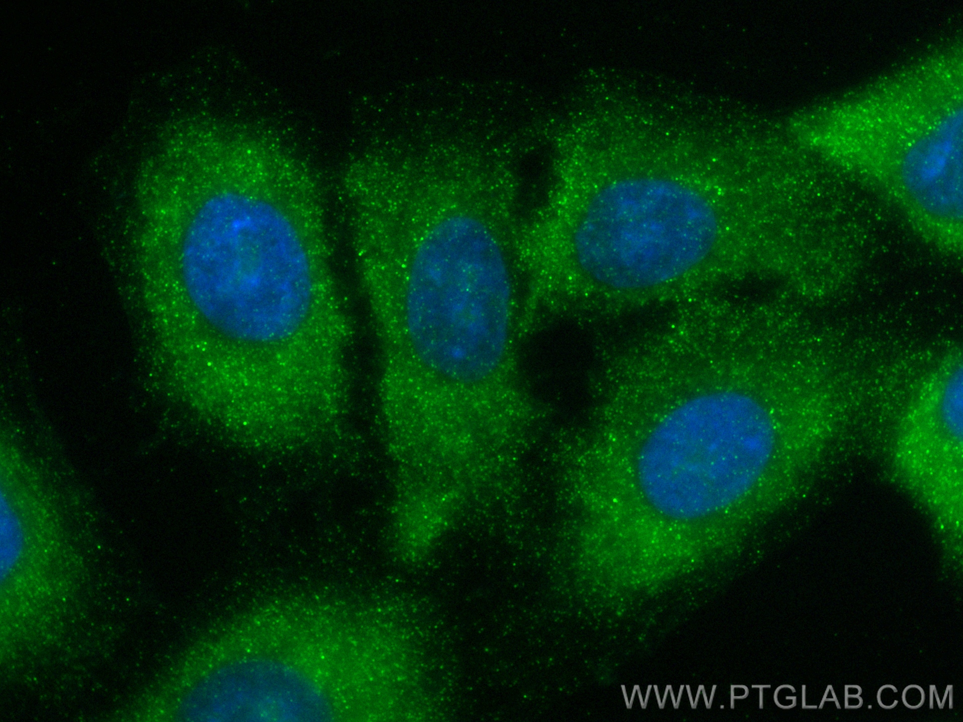 Immunofluorescence (IF) / fluorescent staining of A549 cells using S100A9 Recombinant antibody (83578-2-RR)