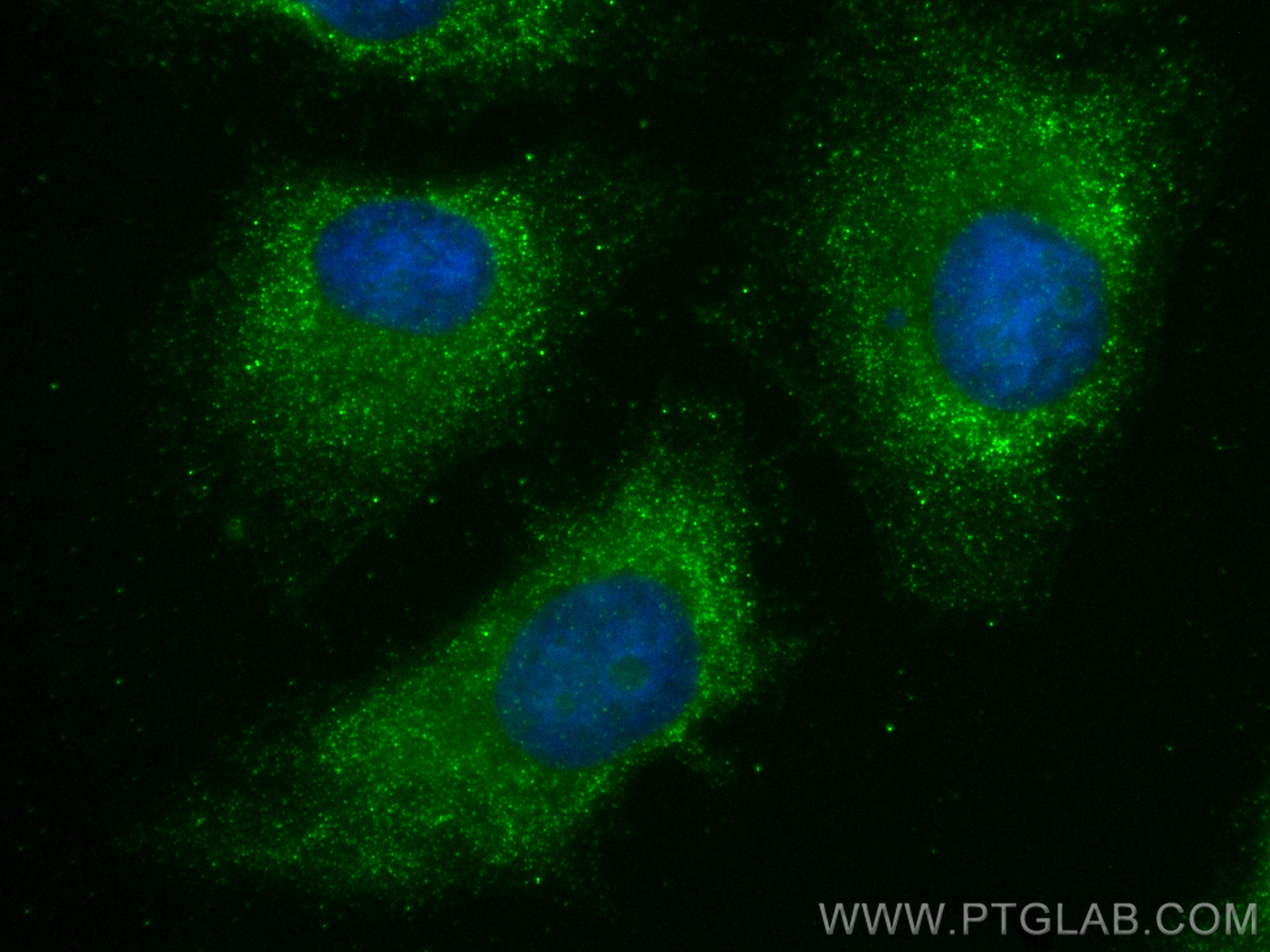 Immunofluorescence (IF) / fluorescent staining of HeLa cells using S100A9 Recombinant antibody (83578-2-RR)