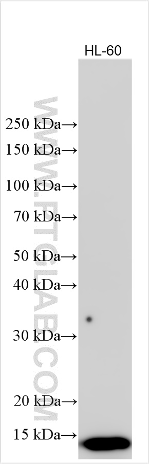 Western Blot (WB) analysis of various lysates using S100A9 Recombinant antibody (83578-2-RR)