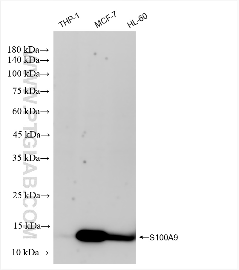 Western Blot (WB) analysis of various lysates using S100A9 Recombinant antibody (83578-2-RR)