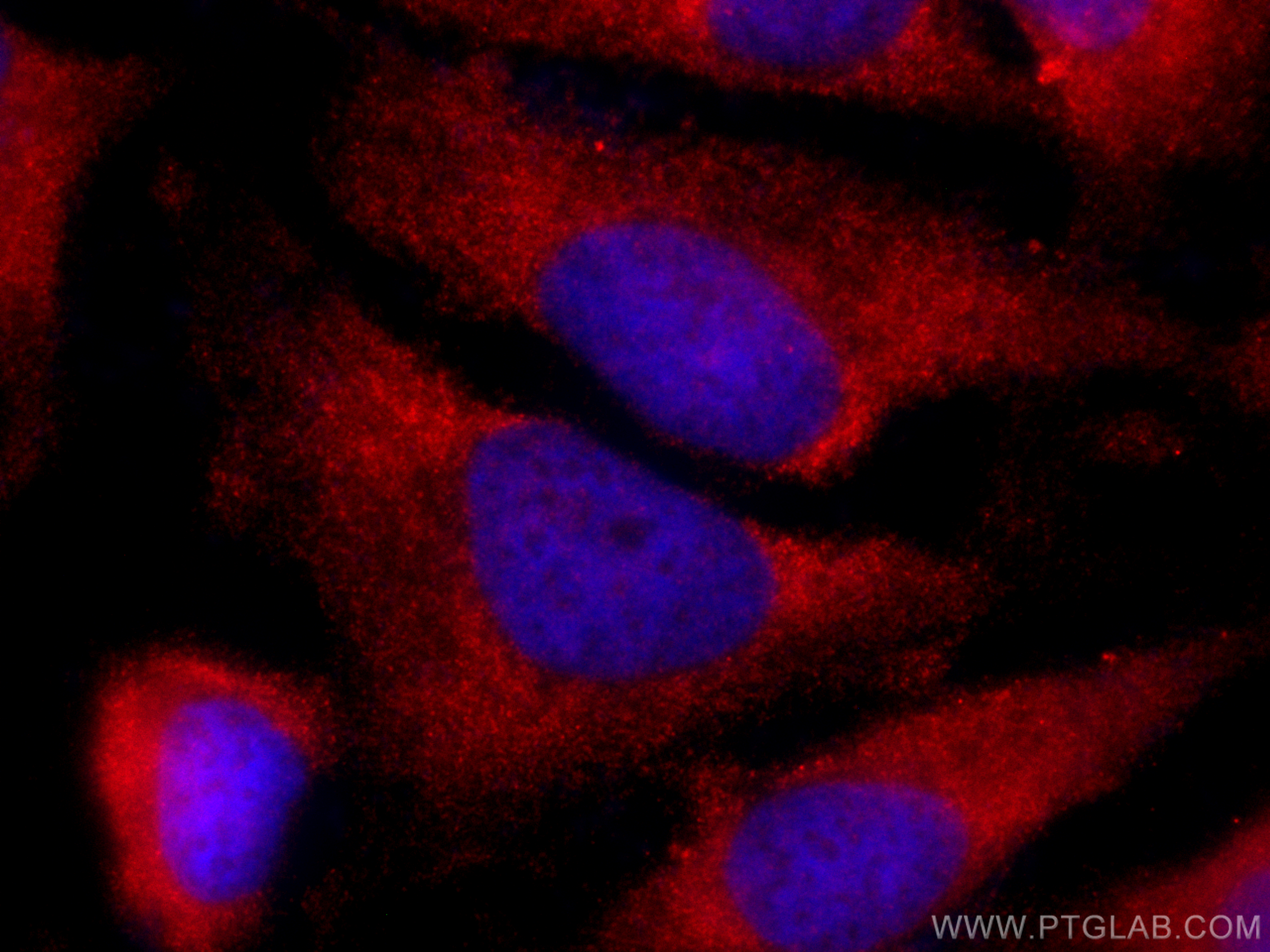 Immunofluorescence (IF) / fluorescent staining of HeLa cells using CoraLite®594-conjugated S100A9 Polyclonal antibody (CL594-26992)