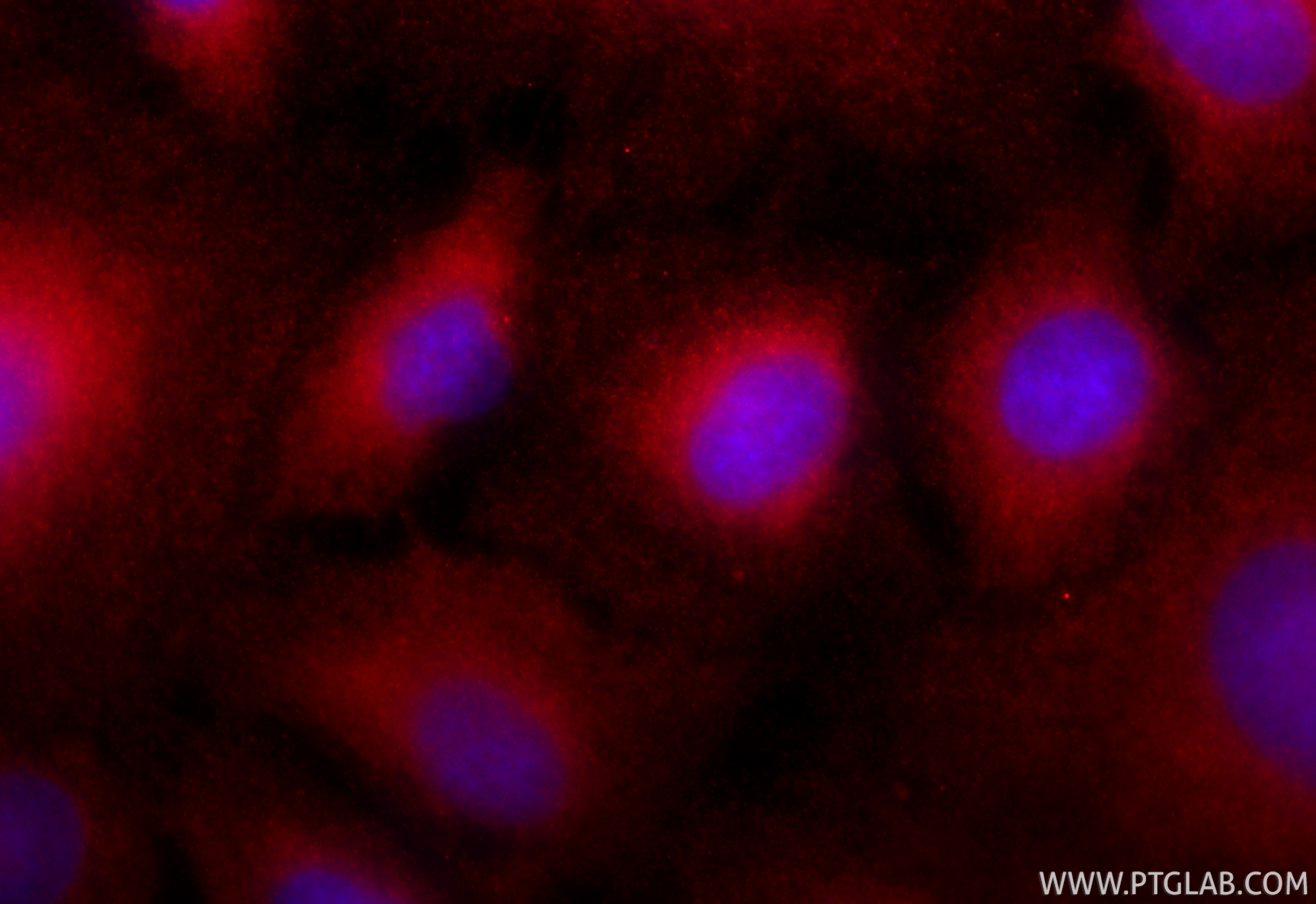 Immunofluorescence (IF) / fluorescent staining of A549 cells using CoraLite®594-conjugated S100A9 Polyclonal antibody (CL594-26992)