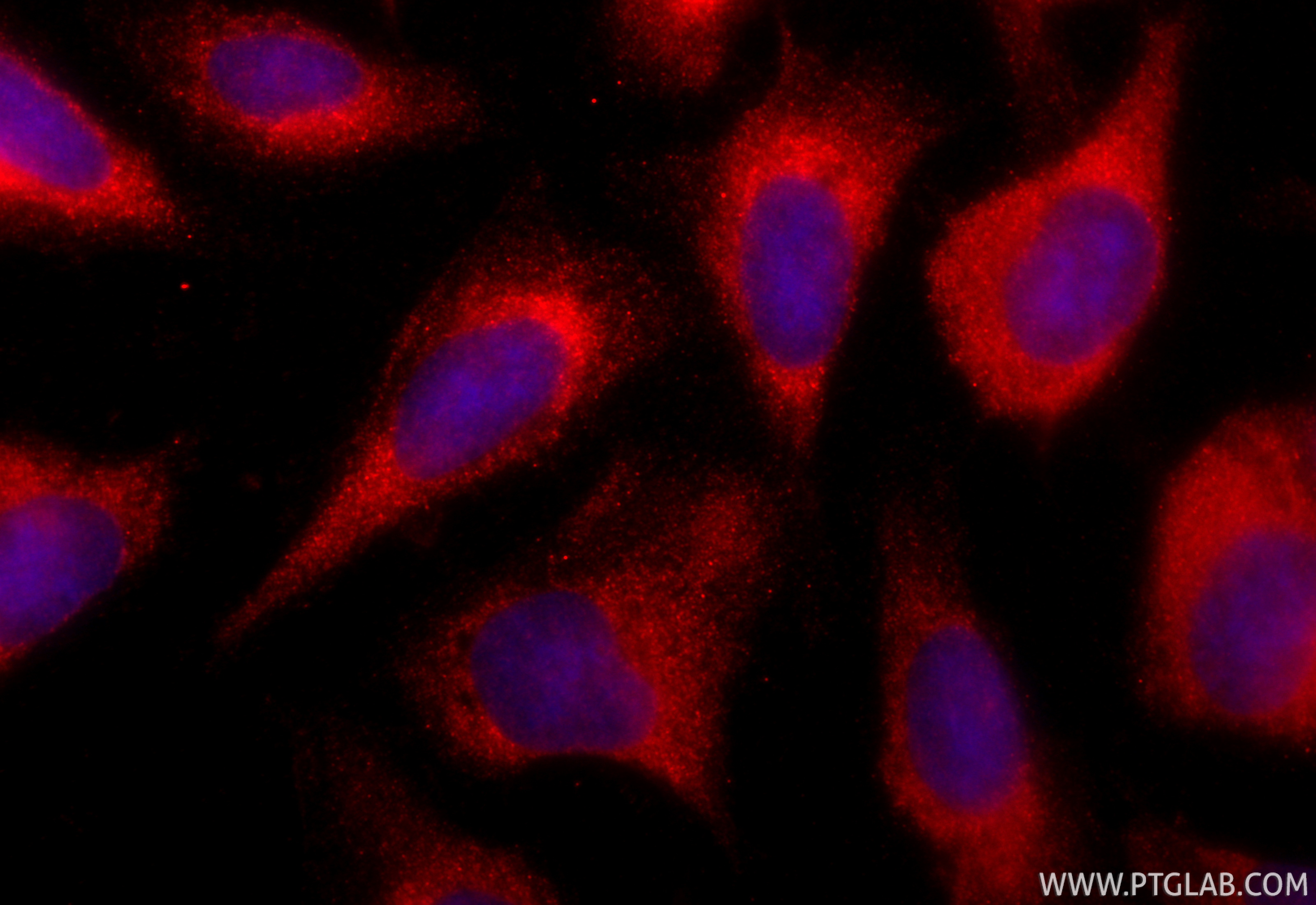 Immunofluorescence (IF) / fluorescent staining of U2OS cells using CoraLite®594-conjugated S100A9 Polyclonal antibody (CL594-26992)