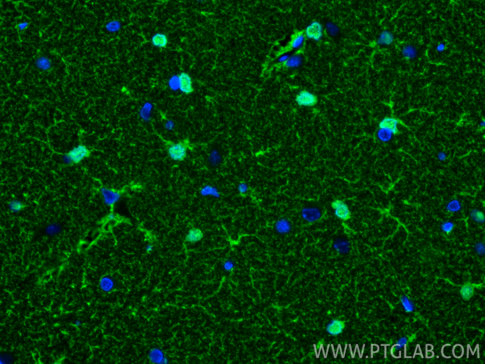 Immunofluorescence (IF) / fluorescent staining of rat brain tissue using S100B Polyclonal antibody (15146-1-AP)