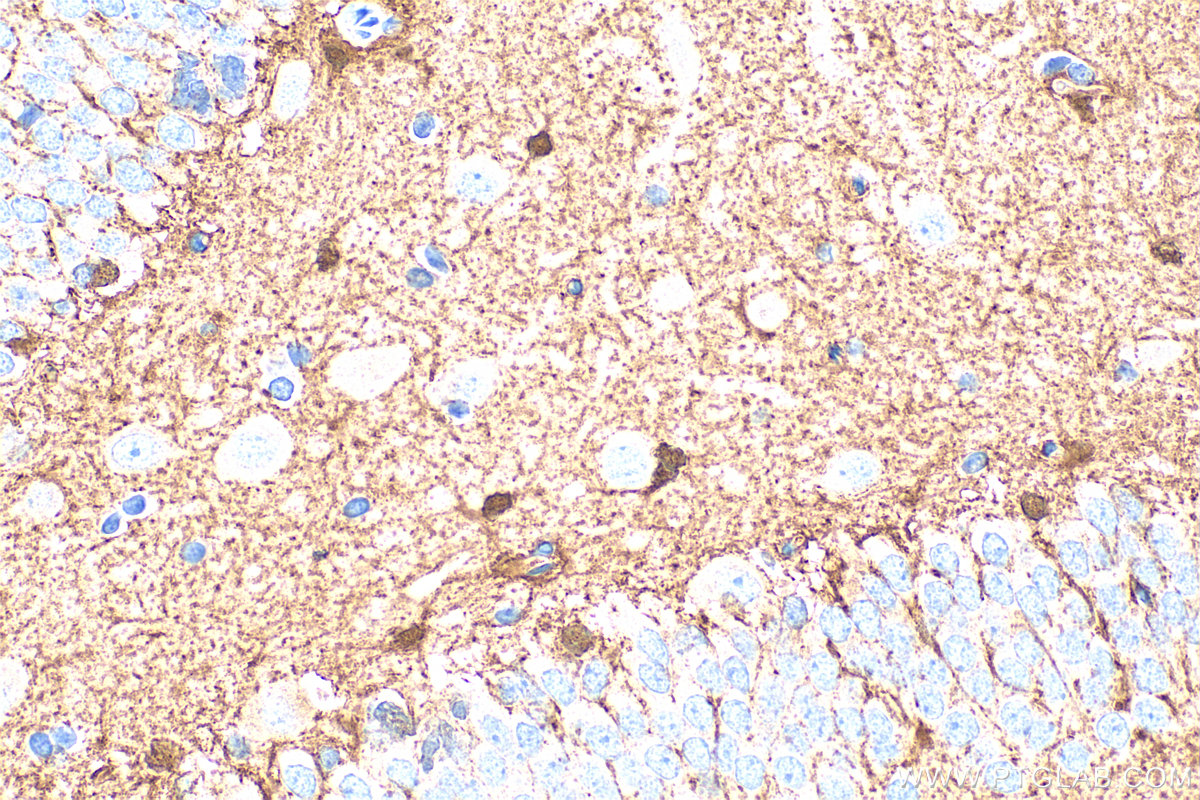 Immunohistochemistry (IHC) staining of rat brain tissue using S100B Polyclonal antibody (15146-1-AP)