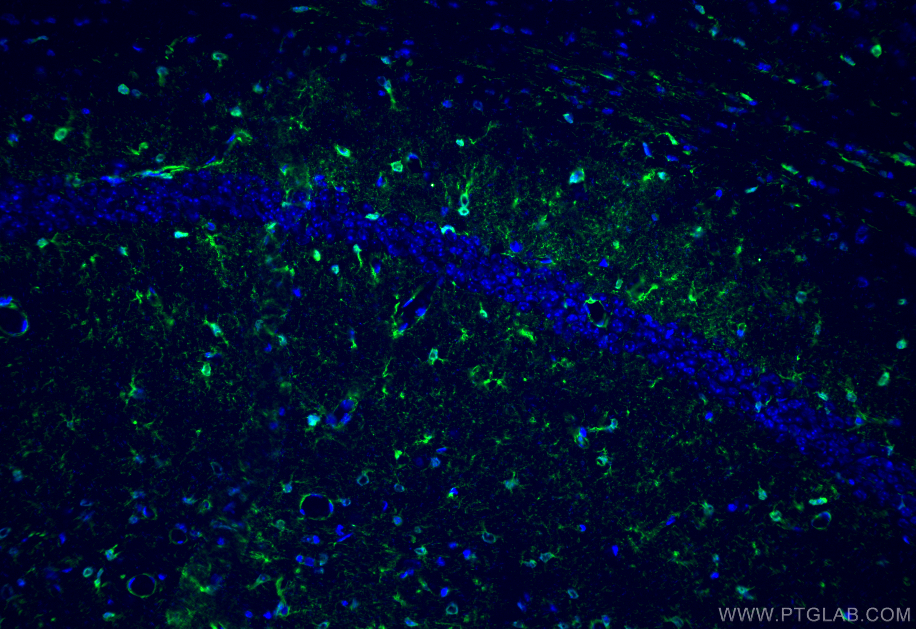 Immunofluorescence (IF) / fluorescent staining of mouse brain tissue using S100B Monoclonal antibody (66616-1-Ig)