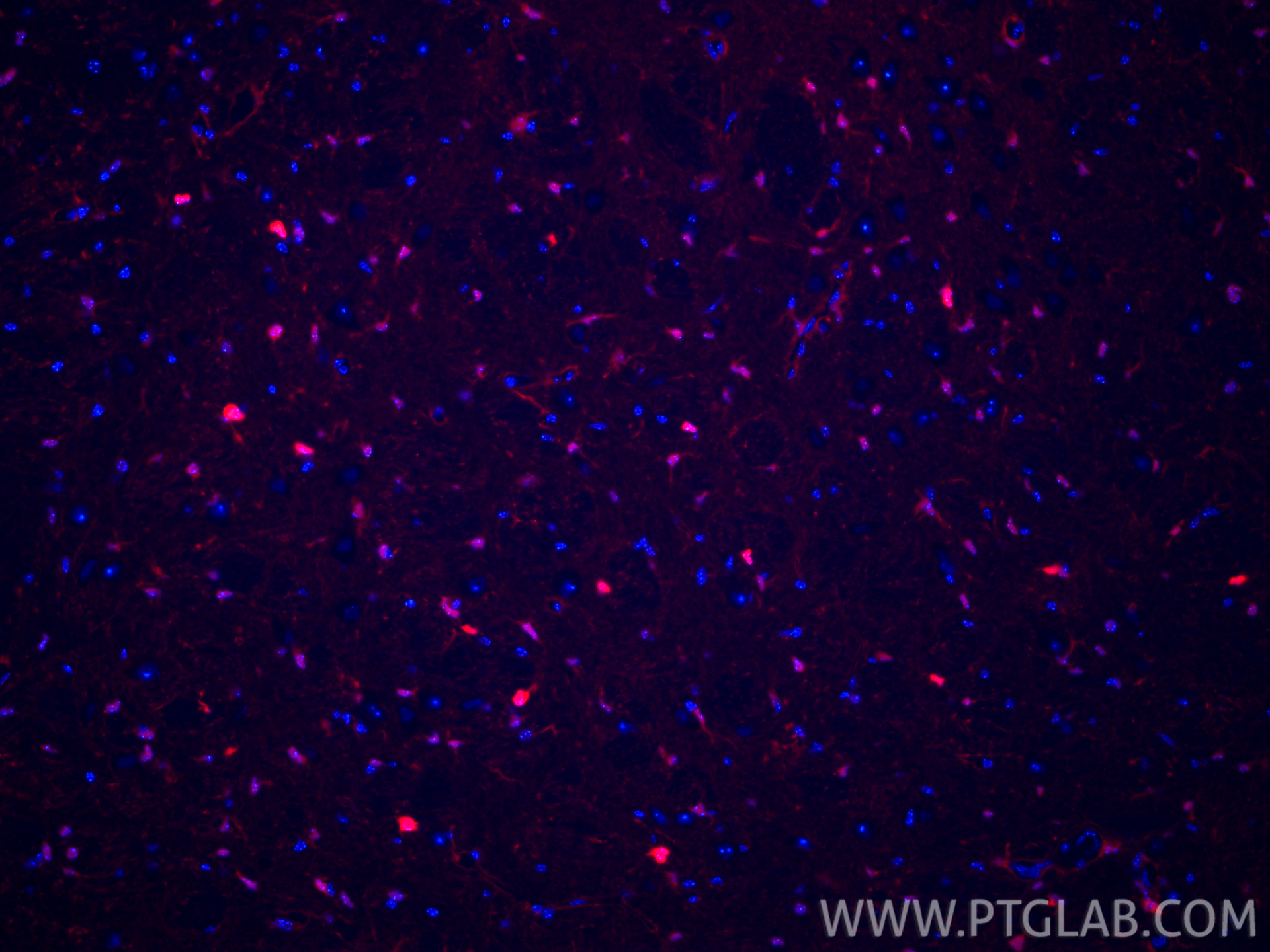 Immunofluorescence (IF) / fluorescent staining of mouse brain tissue using CoraLite®594-conjugated S100B Recombinant monoclon (CL594-82271-8)