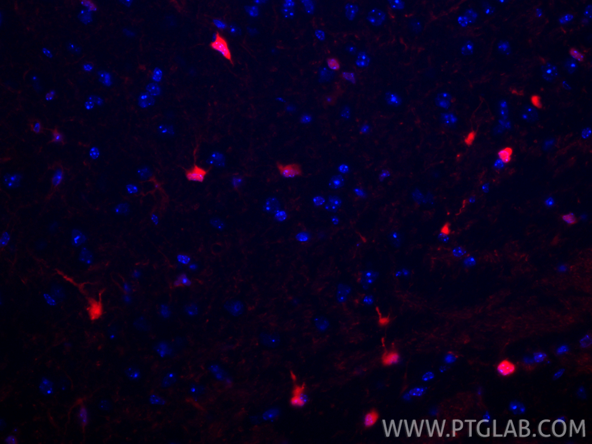 Immunofluorescence (IF) / fluorescent staining of mouse brain tissue using CoraLite®594-conjugated S100B Recombinant monoclon (CL594-82271-8)