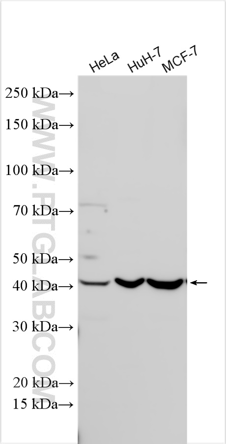 Western Blot (WB) analysis of various lysates using S1PR2 Polyclonal antibody (21180-1-AP)