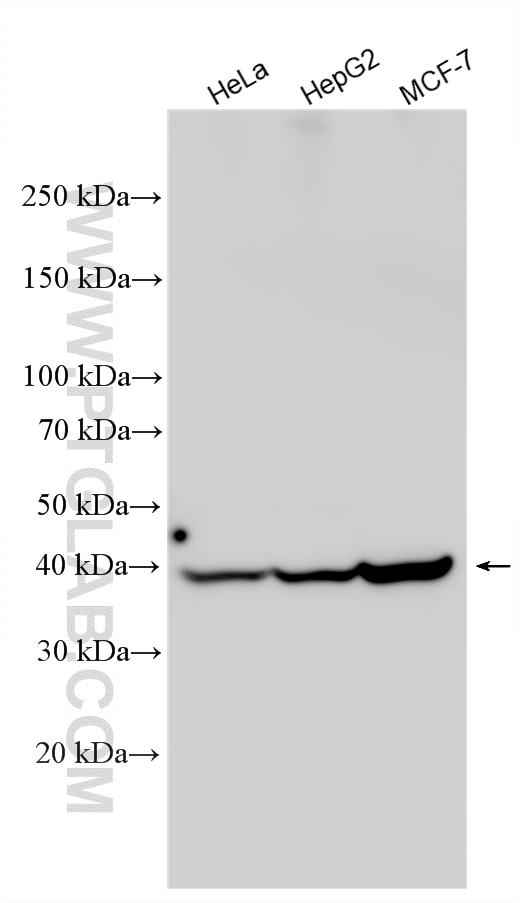 Western Blot (WB) analysis of various lysates using S1PR2 Polyclonal antibody (21180-1-AP)
