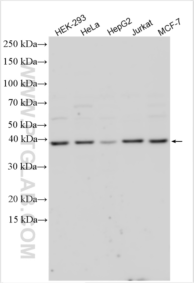 Western Blot (WB) analysis of various lysates using S1PR3 Polyclonal antibody (55204-1-AP)