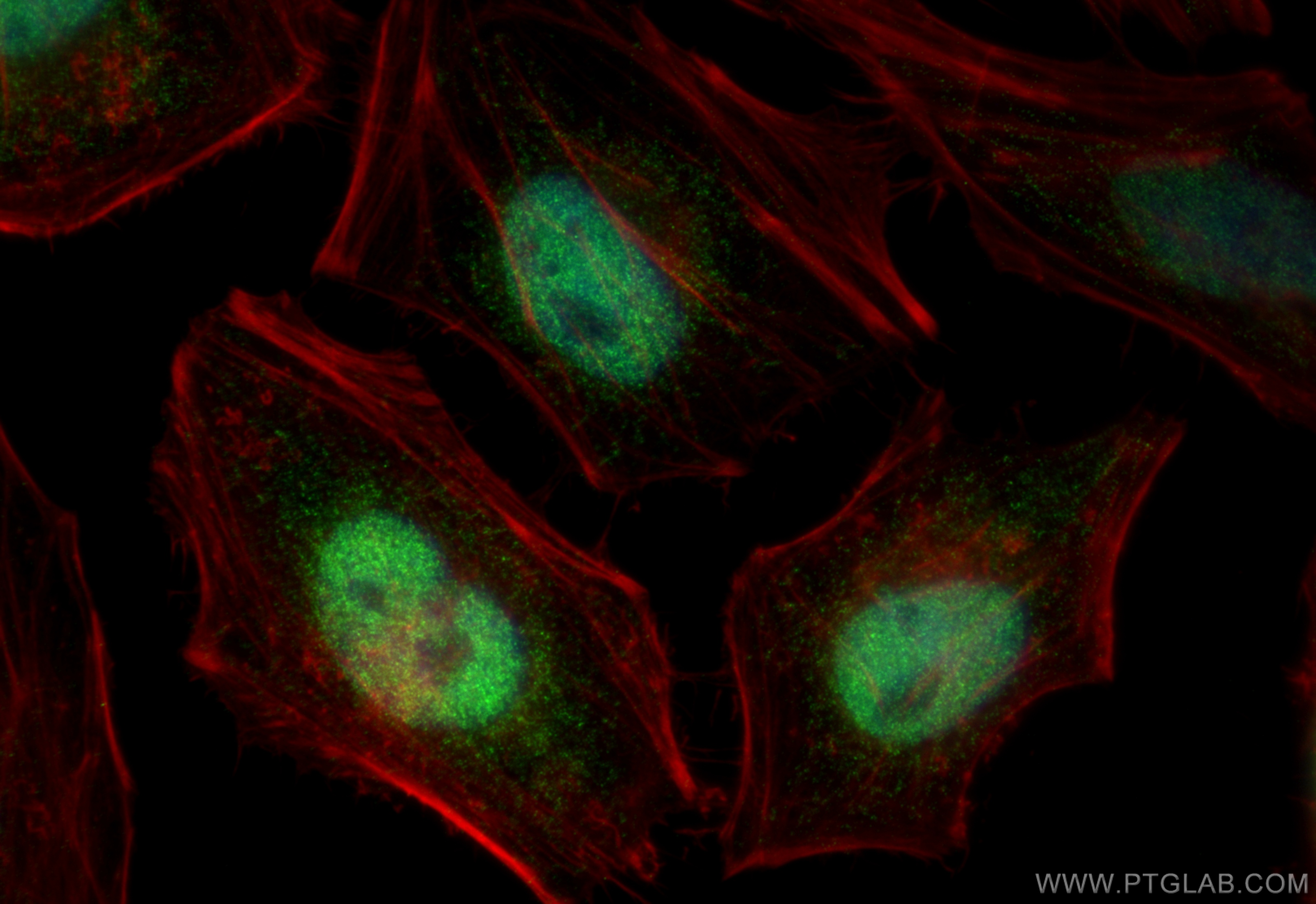 Immunofluorescence (IF) / fluorescent staining of HeLa cells using SAE1 Polyclonal antibody (10229-1-AP)