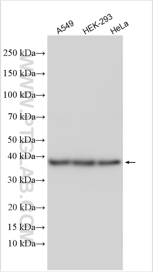 Western Blot (WB) analysis of various lysates using SAE1 Polyclonal antibody (10229-1-AP)