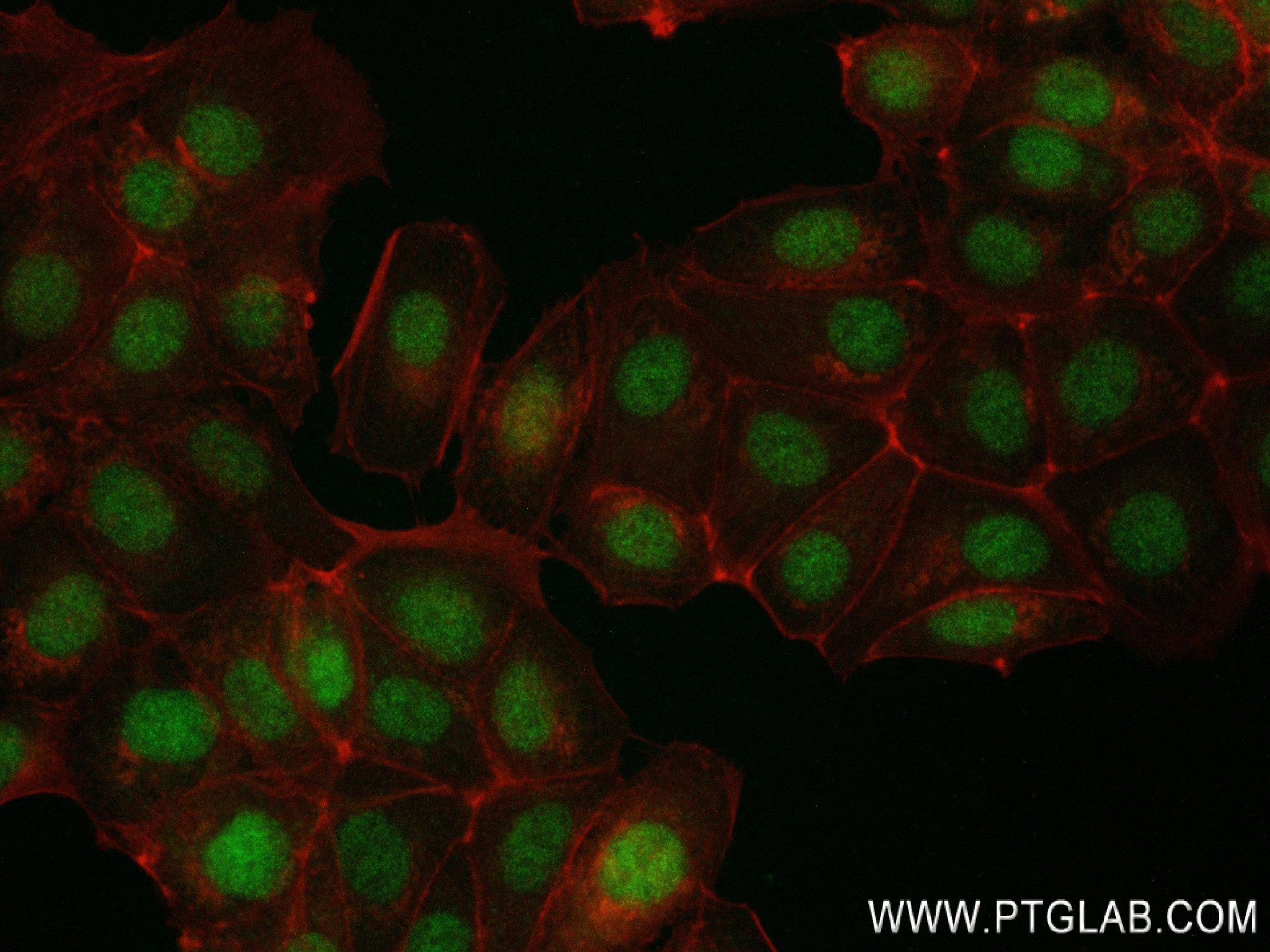 Immunofluorescence (IF) / fluorescent staining of MCF-7 cells using SAE1 Recombinant antibody (84516-6-RR)