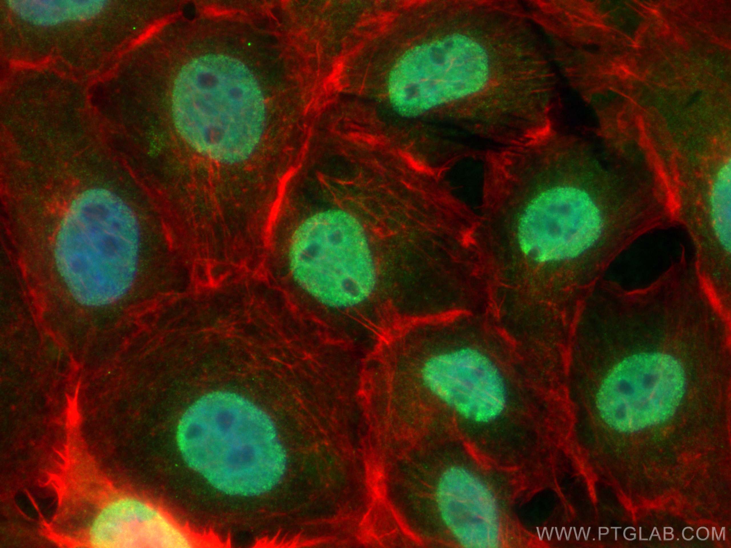 Immunofluorescence (IF) / fluorescent staining of A431 cells using SAFB Polyclonal antibody (21857-1-AP)