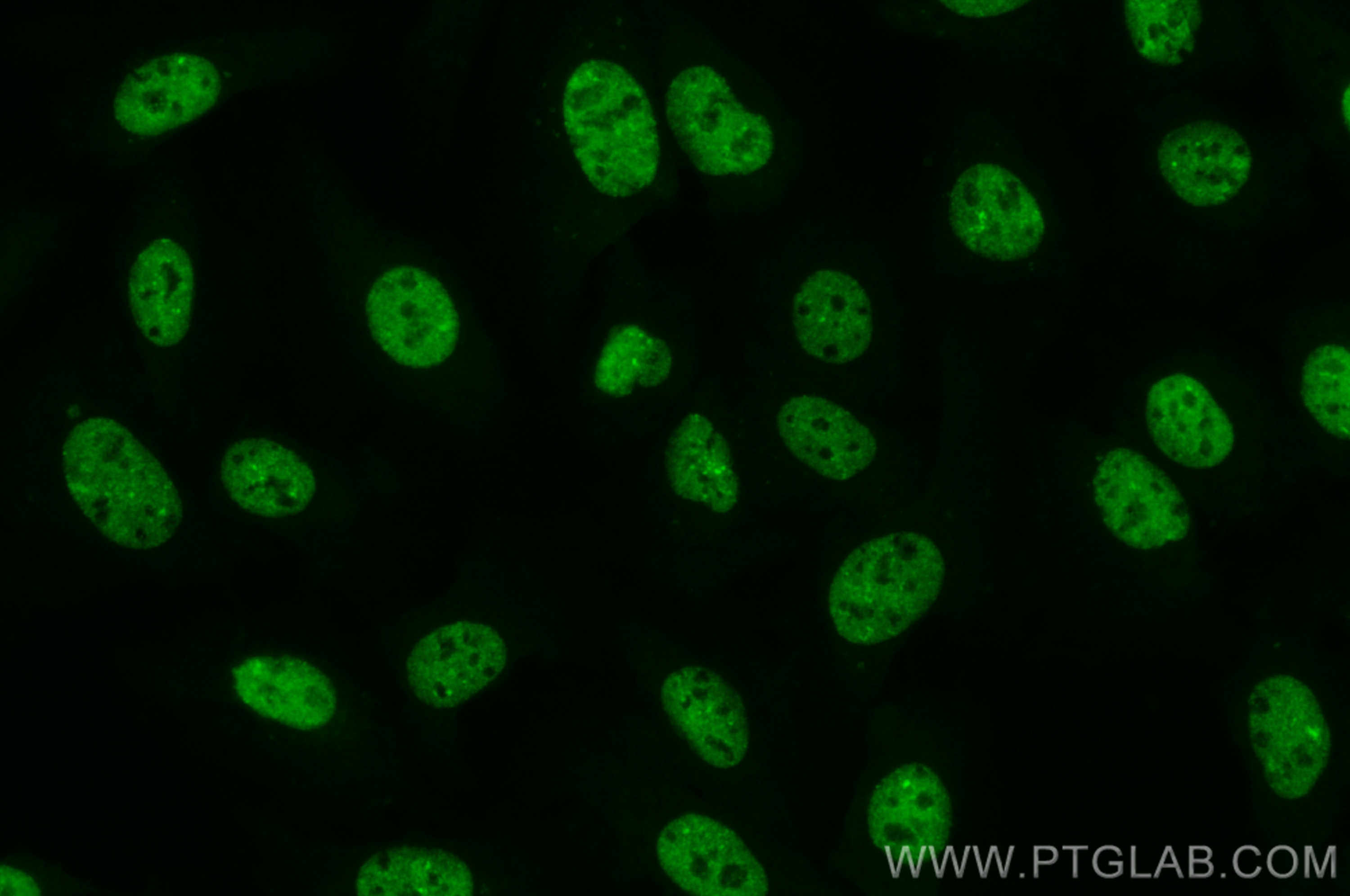 Immunofluorescence (IF) / fluorescent staining of U2OS cells using CoraLite® Plus 488-conjugated SAFB Polyclonal anti (CL488-21857)