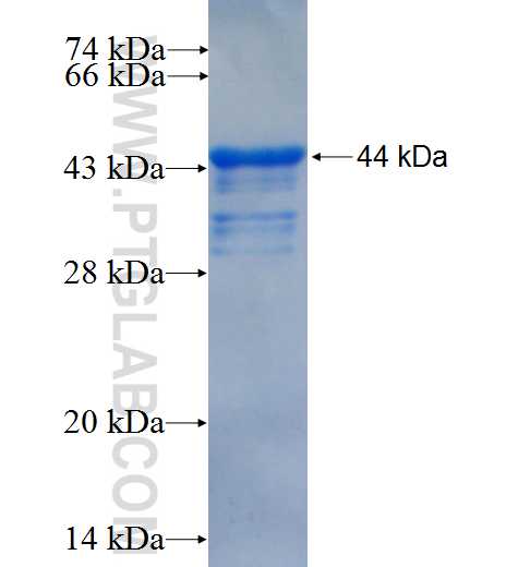 SALL1 fusion protein Ag26766 SDS-PAGE