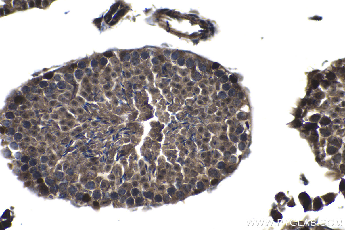 Immunohistochemistry (IHC) staining of mouse testis tissue using SALL4 Polyclonal antibody (24500-1-AP)