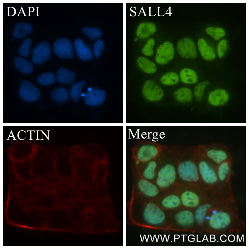 Immunofluorescence (IF) / fluorescent staining of Caco-2 cells using SALL4 Recombinant antibody (83039-4-RR)