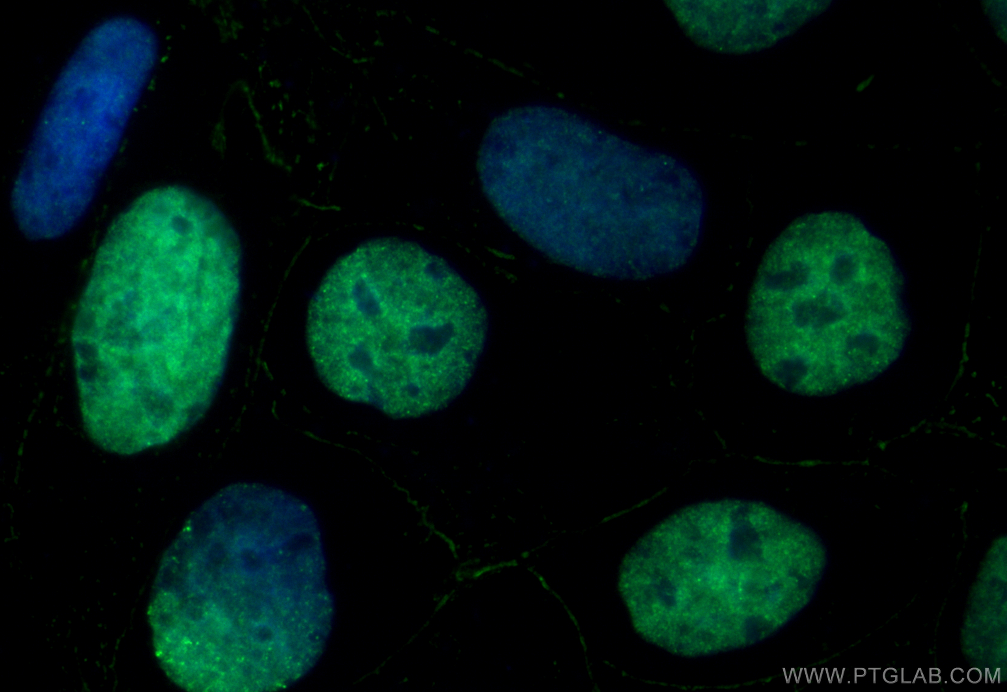 Immunofluorescence (IF) / fluorescent staining of Caco-2 cells using CoraLite® Plus 488-conjugated SALL4 Recombinant an (CL488-83039-4)