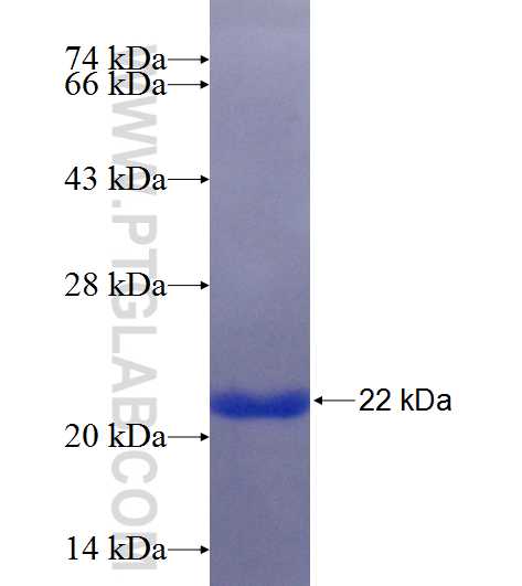 SAMD8 fusion protein Ag25321 SDS-PAGE