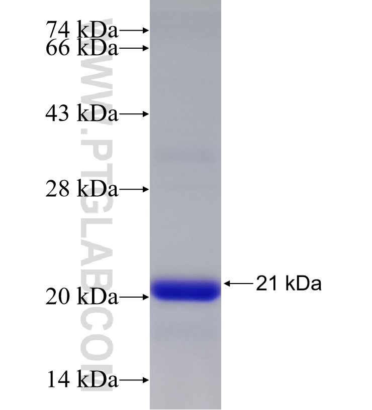 SAMD8 fusion protein Ag33150 SDS-PAGE