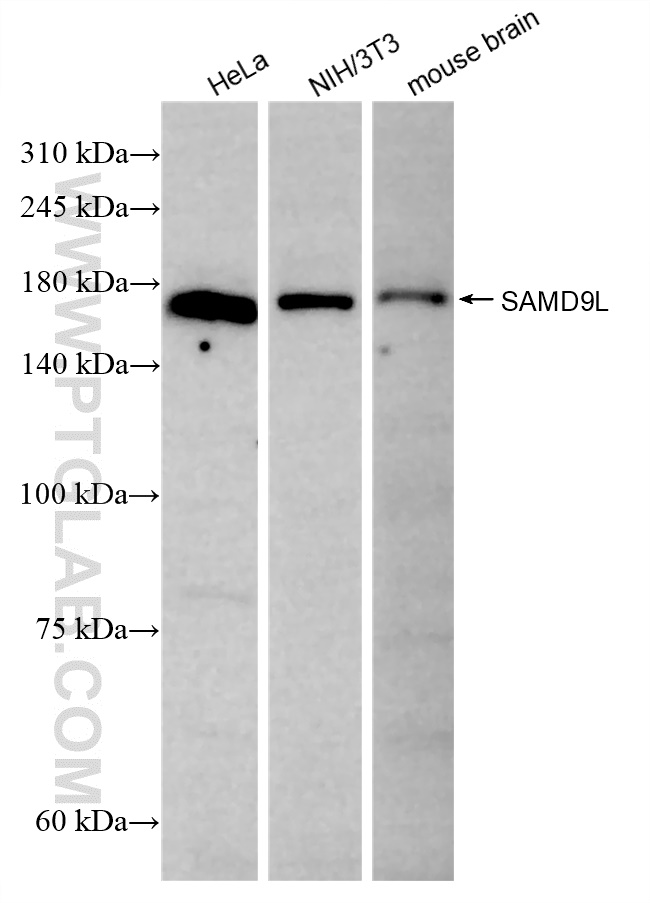 Western Blot (WB) analysis of various lysates using SAMD9L Recombinant antibody (84109-1-RR)