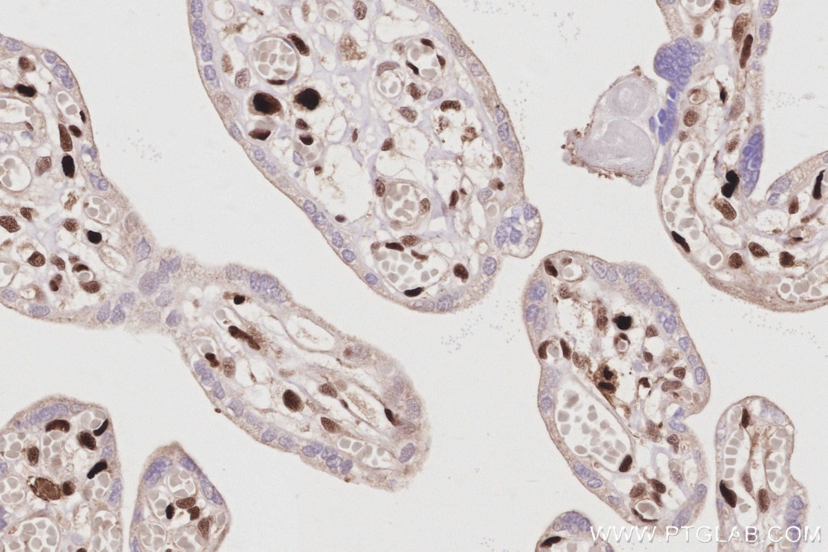 Immunohistochemistry (IHC) staining of human placenta tissue using SAMHD1 Polyclonal antibody (12586-1-AP)