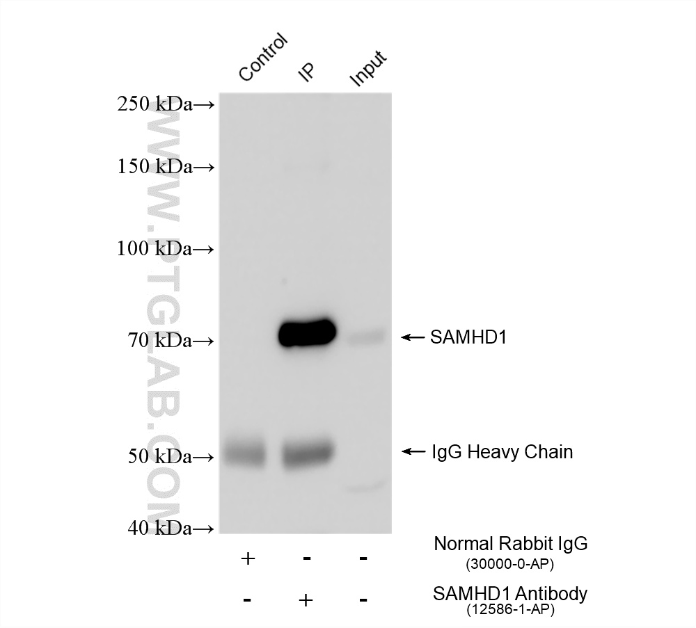 Immunoprecipitation (IP) experiment of K-562 cells using SAMHD1 Polyclonal antibody (12586-1-AP)
