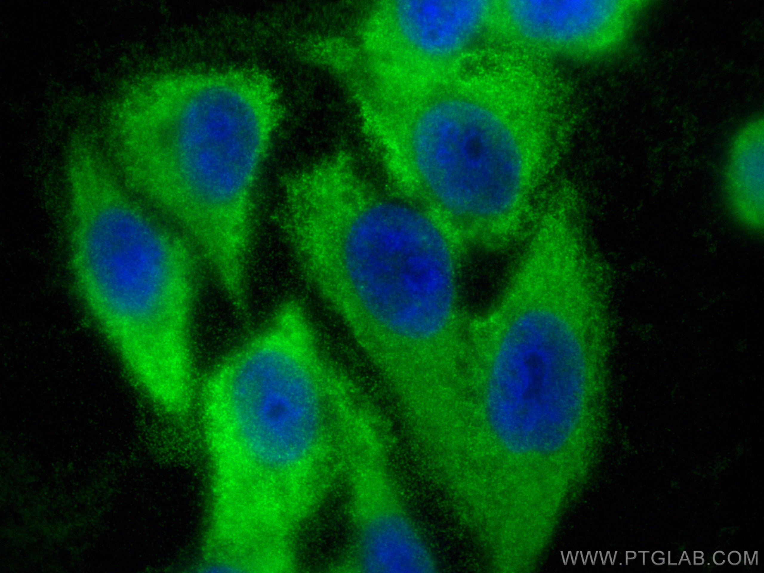 Immunofluorescence (IF) / fluorescent staining of HepG2 cells using SAR1A Recombinant antibody (83168-7-RR)