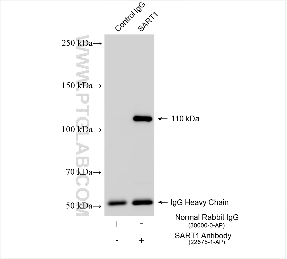 Immunoprecipitation (IP) experiment of mouse brain tissue using SART1 Polyclonal antibody (22675-1-AP)