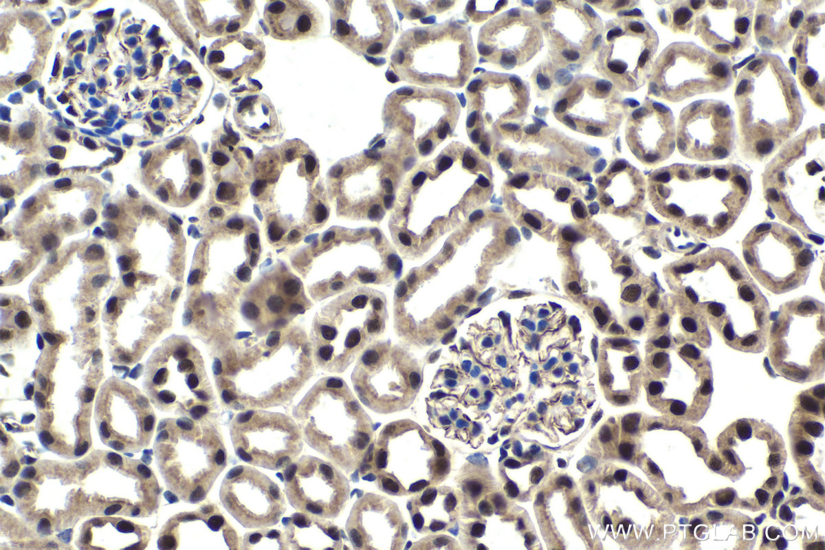 Immunohistochemistry (IHC) staining of mouse kidney tissue using SART3 Polyclonal antibody (18025-1-AP)