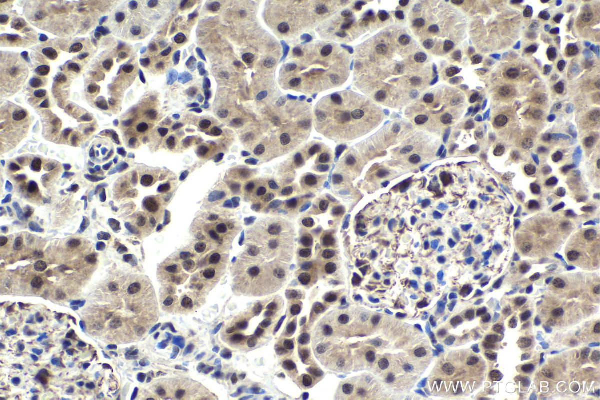 Immunohistochemistry (IHC) staining of rat kidney tissue using SART3 Polyclonal antibody (18025-1-AP)