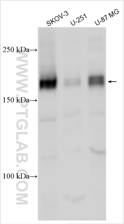 Western Blot (WB) analysis of various lysates using SASH1 Polyclonal antibody (27689-1-AP)