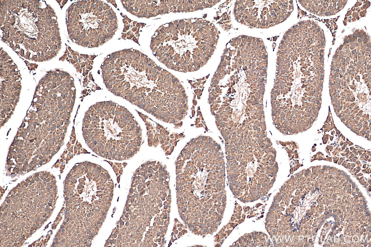 Immunohistochemistry (IHC) staining of mouse testis tissue using SASS6 Polyclonal antibody (21377-1-AP)