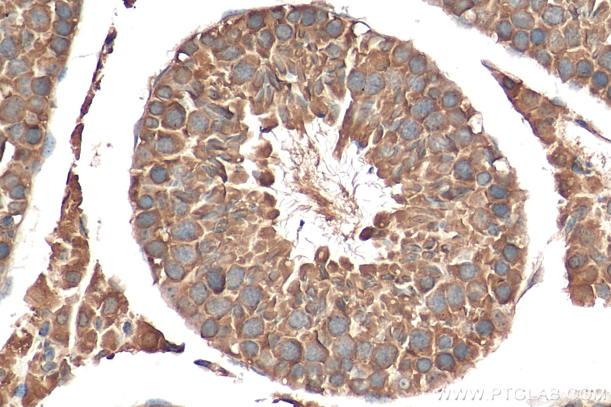 Immunohistochemistry (IHC) staining of mouse testis tissue using SASS6 Polyclonal antibody (21377-1-AP)