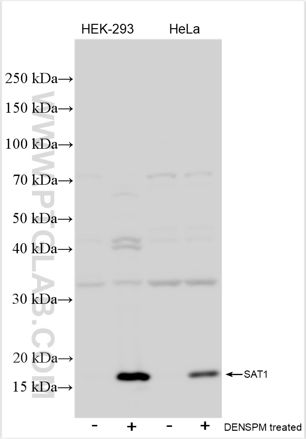 Western Blot (WB) analysis of various lysates using SAT1 Polyclonal antibody (10708-1-AP)