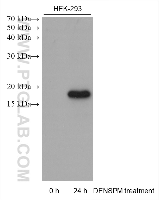 Western Blot (WB) analysis of various lysates using SAT1 Monoclonal antibody (68928-1-Ig)