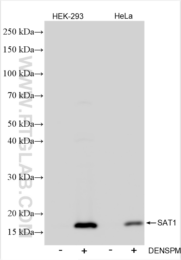 Western Blot (WB) analysis of various lysates using SAT1 Recombinant antibody (83319-1-RR)