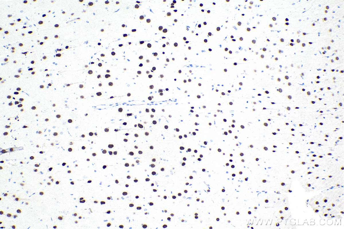 Immunohistochemistry (IHC) staining of rat brain tissue using SATB1 Polyclonal antibody (15400-1-AP)